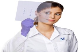 Western Blotting