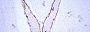 Primary Antibodies for Western Blotting