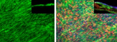 Figure 2. Single layer (left) and stacked (right) cell sheets fabricated on Nunc UpCell surfaces. Individual cell monolayers were pre-stained with CellTracker dyes for better visualization. Inset: Cross sectional view of the respective cell sheets. Figure 2. Single layer (left) and stacked (right) cell sheets fabricated on Nunc UpCell surfaces. Individual cell monolayers were pre-stained with CellTracker dyes for better visualization. Inset: Cross sectional view of the respective cell sheets.