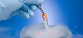 Cryostorage