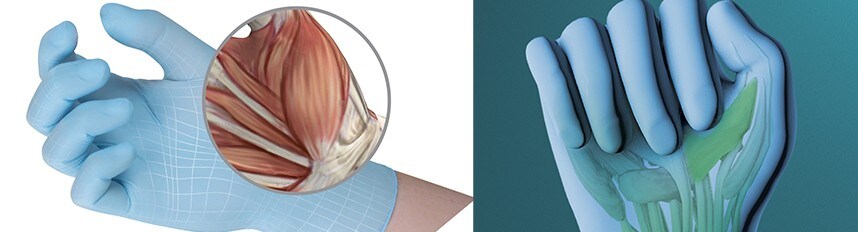 Meilleure conception : protection ergonomique des mains